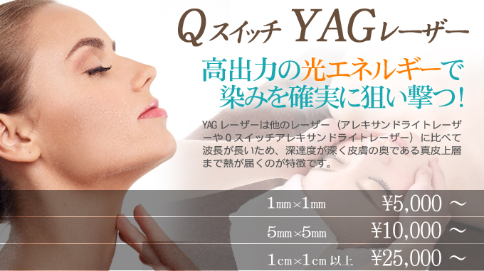 Q�X�C�b�`�@YAG���[�U�[�@���e�@�A���`�G�C�W���O�@����